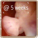 Foot @ 5 weeks