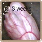 Foot @ 8 weeks