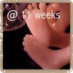 Feet @ 12 weeks