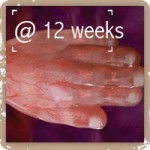 Hand @ 12 weeks