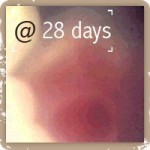 Heart beat @ 28 days