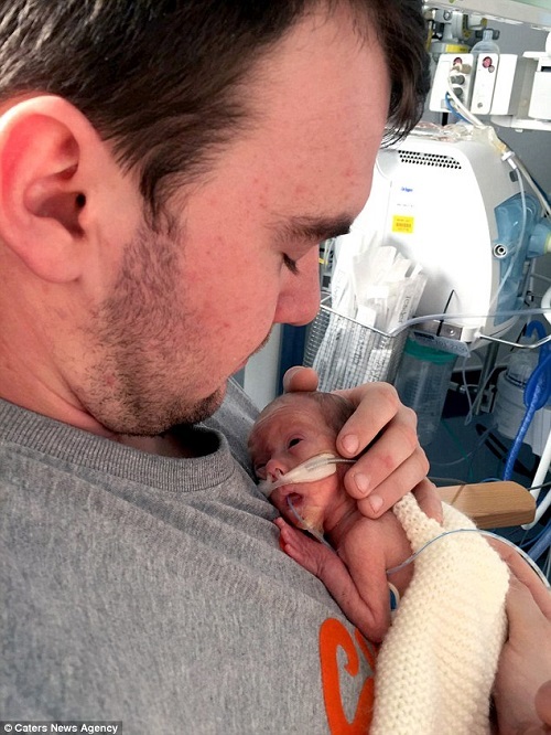 premature babies 24 weeks survival rate