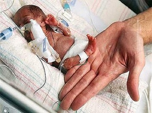 2 pound premature baby
