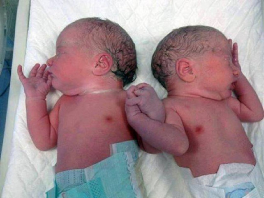 twins-in-the-womb